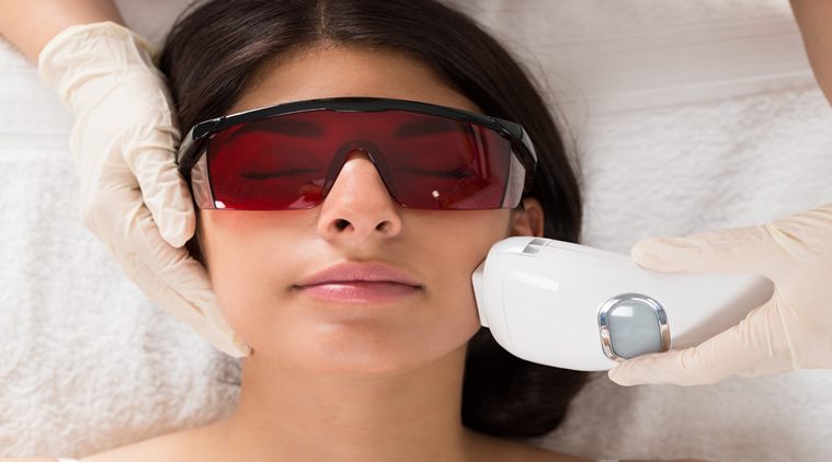 unwanted laser hair removal